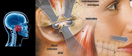 Disfunciones en la ATM (articulación temporomandibular)