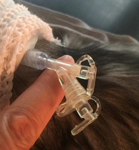 Her er enden hvor maten og medisinen sprøytes inn.