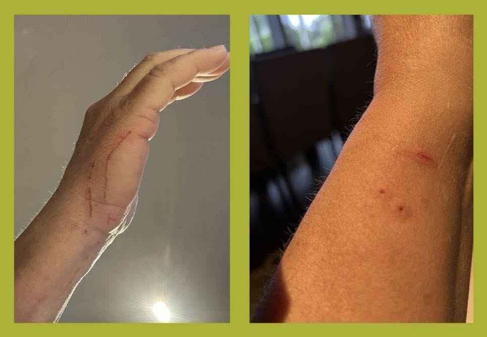 hånd og arm med katteklor
