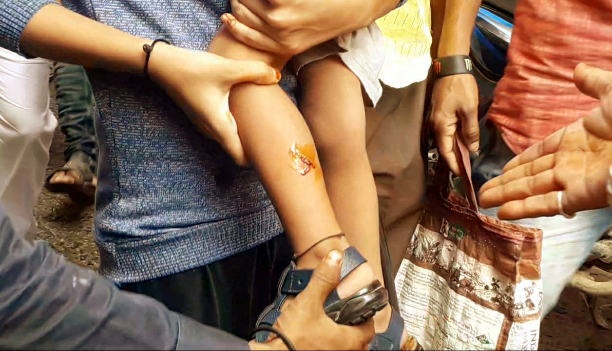 दमोह शहर में घुसा तेंदुआ, एक बच्ची को किया घायल, शहर में फैली दहशत | New India Times
