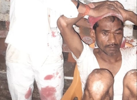 दबंगों ने एक राय होकर 50 वर्षीय युवक पर किया प्राणघातक हमला | New India Times