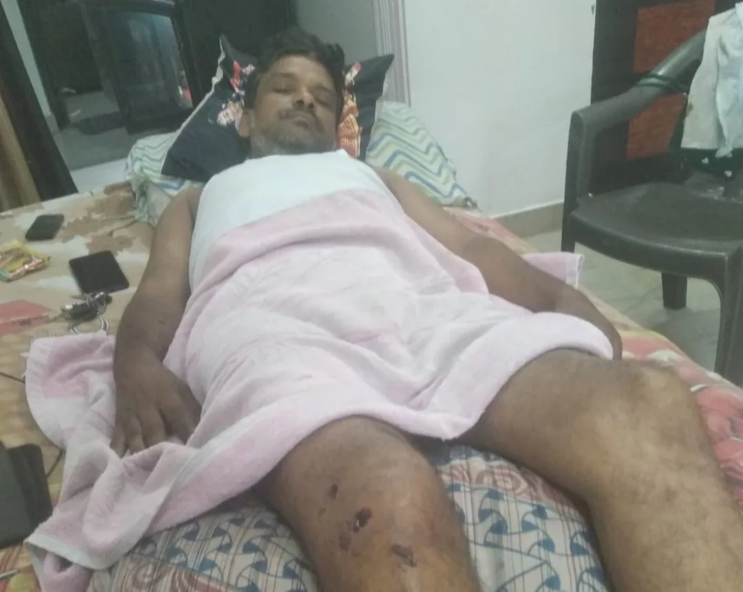 मथुरा के पत्रकार मुकेश कुमार गुप्ता पर हुआ जानलेवा हमला, नामजद एफआईआर दर्ज होने और कई दिन बीत जाने के बाद भी पुलिस ने अब तक नहीं की कोई कार्रवाई | New India Times