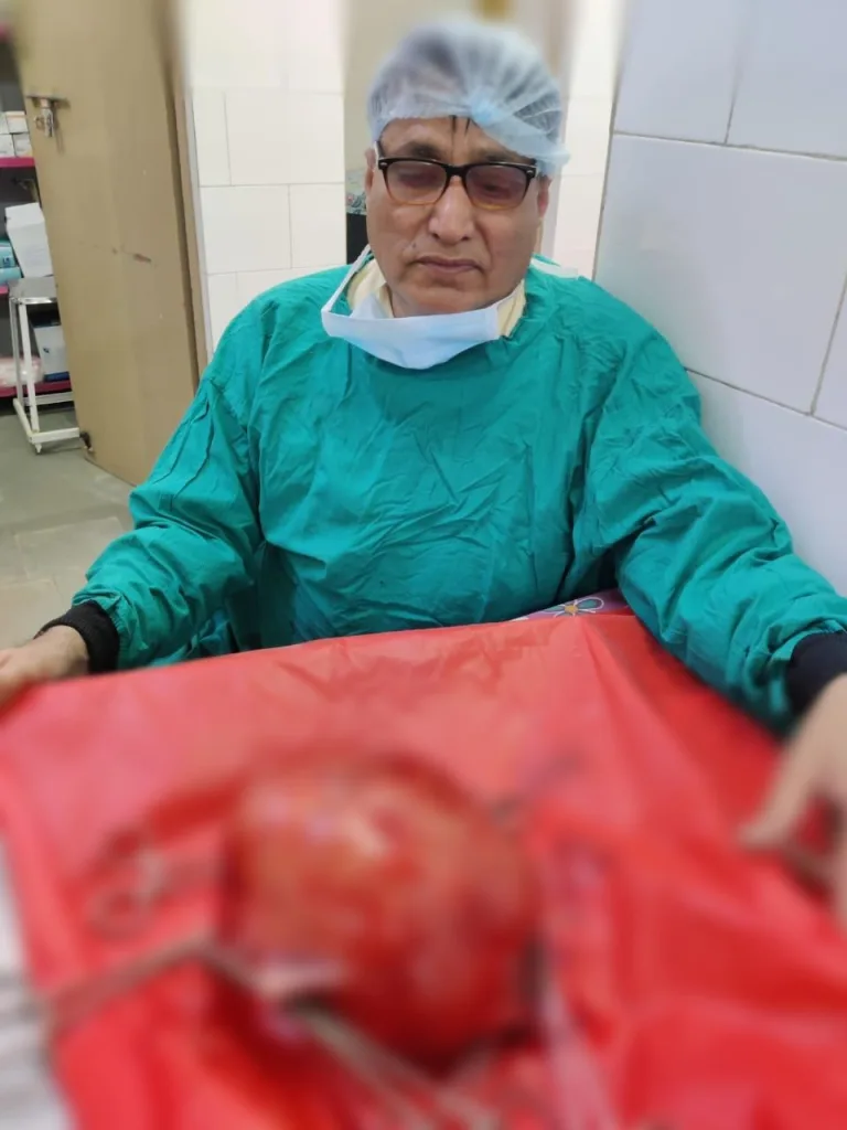 महिला की बच्चेदानी सेे 3 किलो 800 ग्राम की गांठ निकाली, राजकीय धानुका उप जिला अस्पताल फतेहपुर में हुआ महिला का ऑपरेशन | New India Times