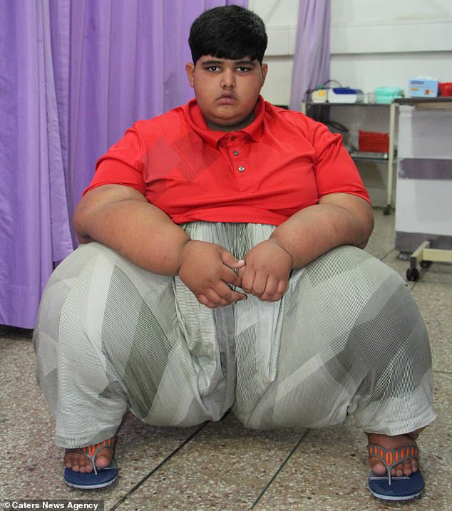 Despite weighing just 8lb at birth, he began gaining weight rapidly - tipping the scales at three stone when he was just six months old