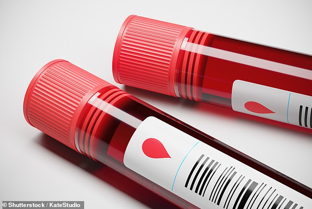 Blood test could diagnose concussion by picking up proteins released by ...