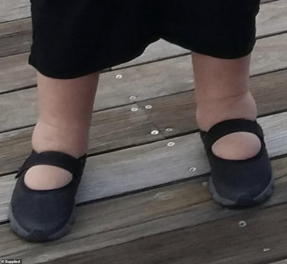 'I had too much fluid build-up in my feet, nothing would fit,' she says. Brenda only had one pair of shoes; a cheap, ugly orthopaedic pair from the pharmacist were the only ones that fit her