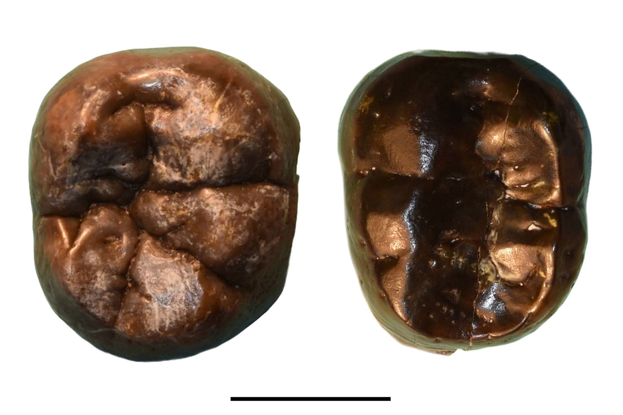Pitting on Omo nonrobust teeth