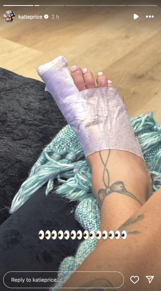 Katie Price's bandaged foot