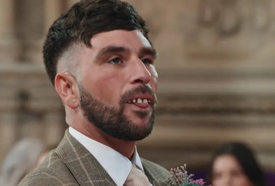 Married At First Sight UK star Kieran wearing joke teeth