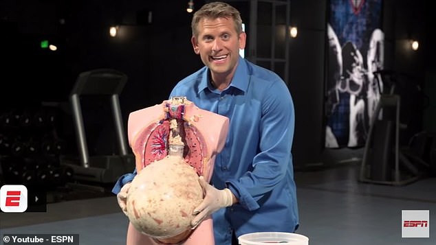 This model demonstrates what the stomach might look like after eating 69 hotdogs and buns