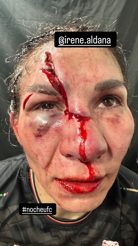 Dana White posts picture of Irene Aldana cut on Instagram