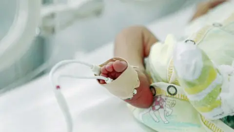 Getty Images A premature baby in hospital with a tube connected to their foot