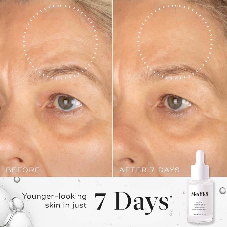 Before and after images from Medik8 showing improvement to skin firmness and plumpness after 7 days of using its serum