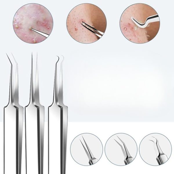 15Pcs Stainless Steel Blackhead Remover Pimple Popper Tools Kit with Metal Case_5