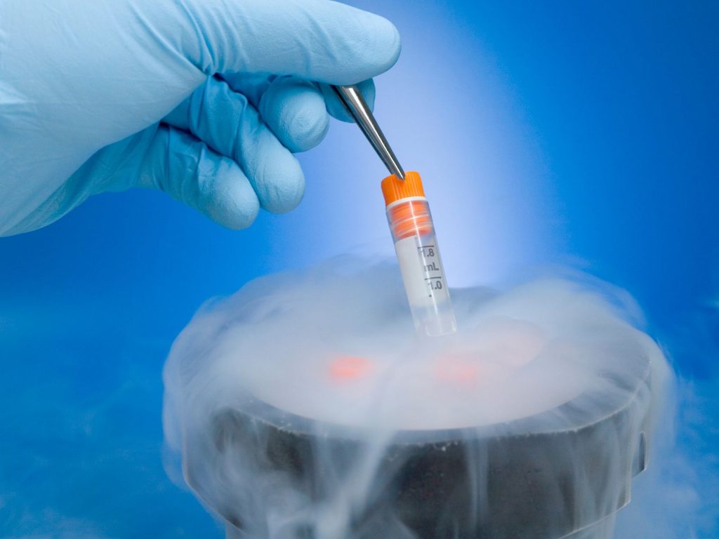 Cryopreservation