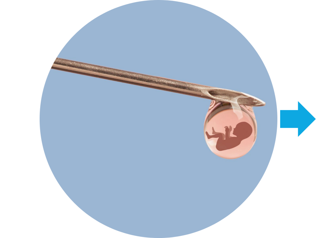 Embryo transfer