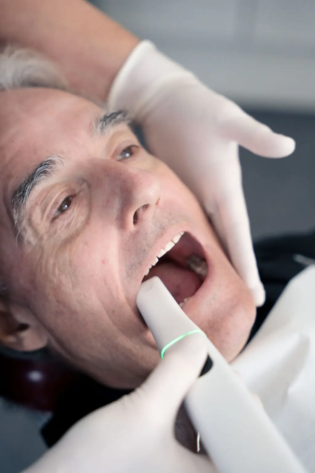 Digital scanning af tænder med intraoral scanner hos tandlægerne Ølandshus på Amager