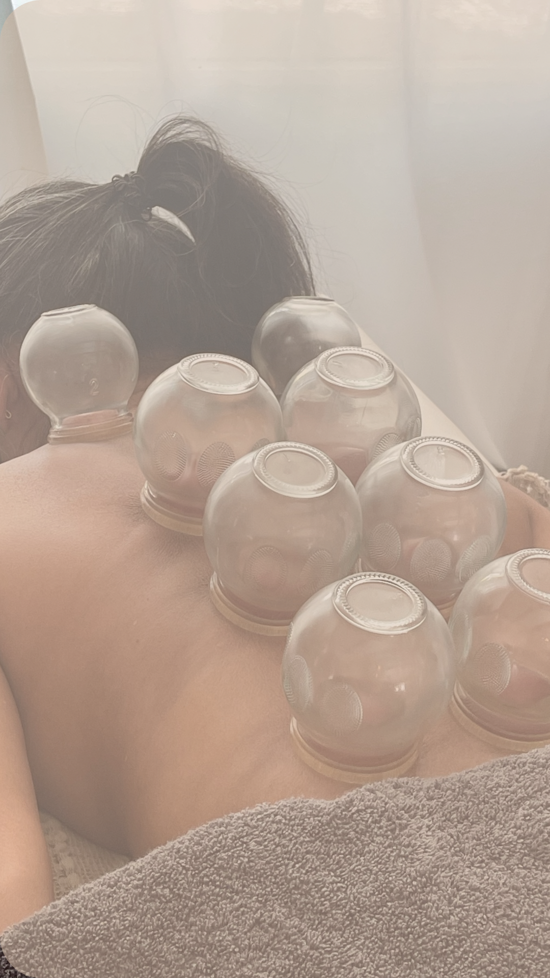 vuurcupping glazen, vuurcupping, cupping, immuunsysteem versterken