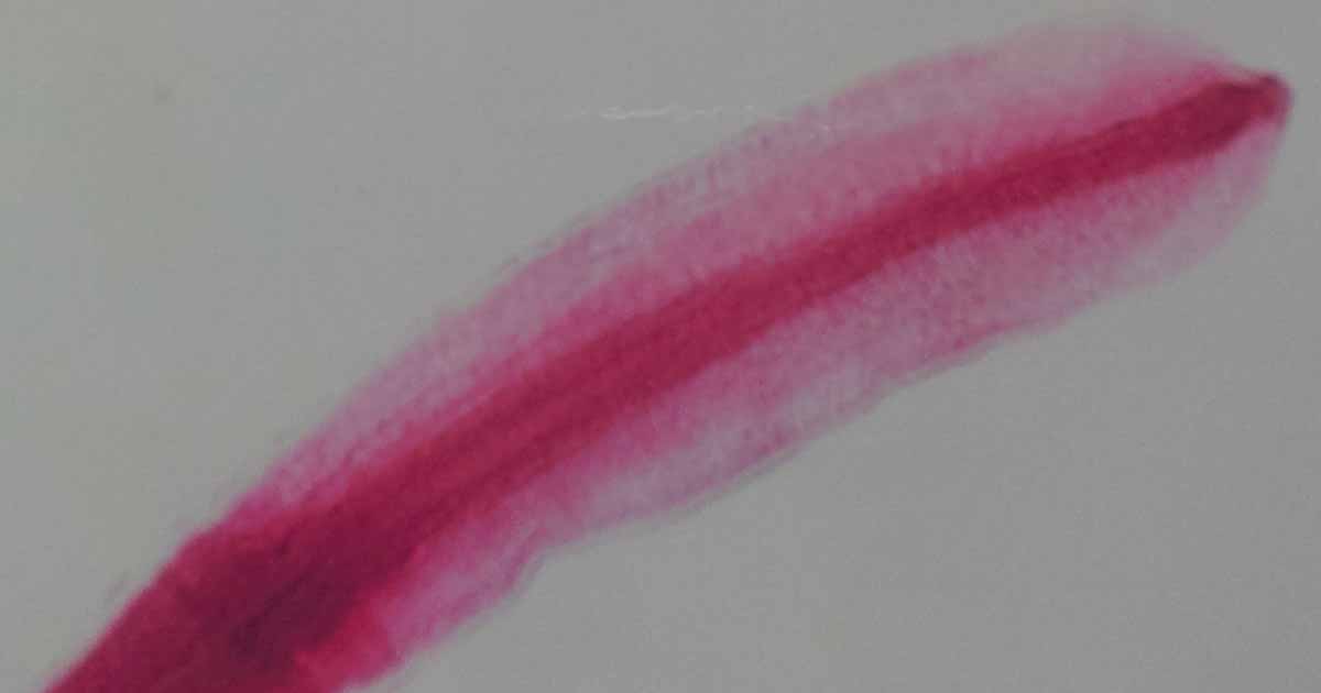 Diphyllobothrium latum (Broad fish tapeworm) ParasiteClinic