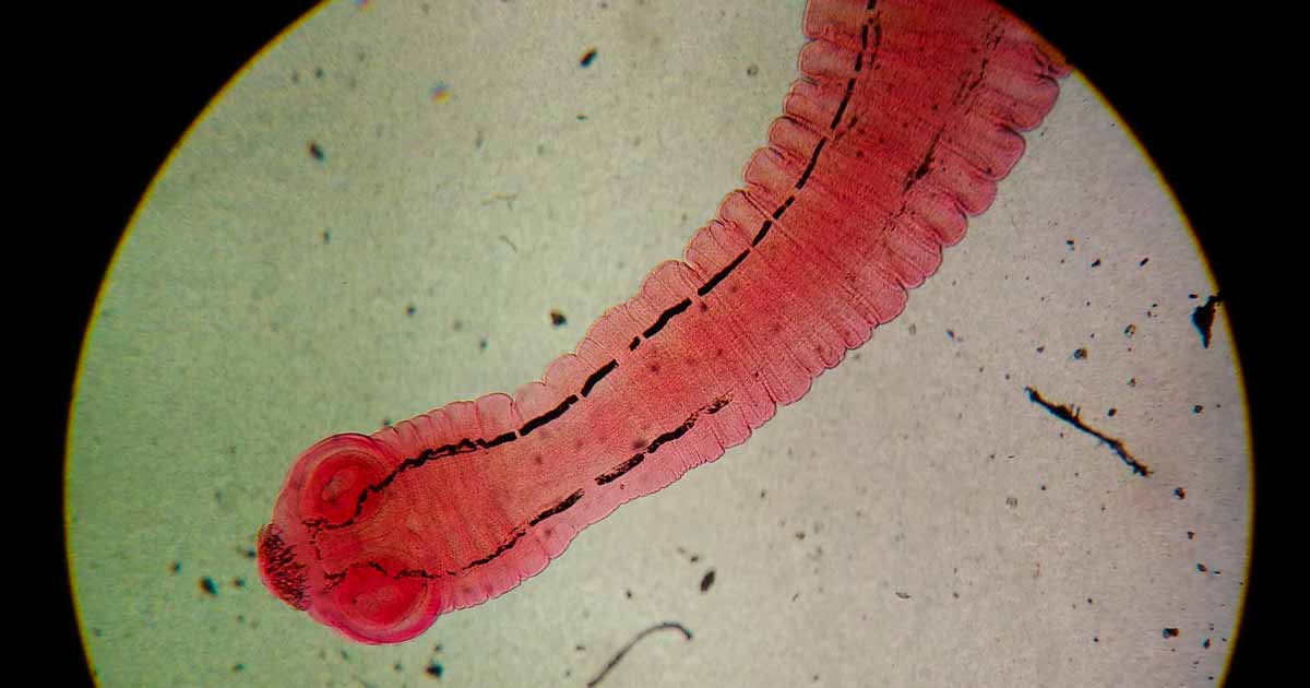 Taenia Saginata Beef Tapeworm ParasiteClinic Taenia Saginata Beef Tapeworm ParasiteClinic