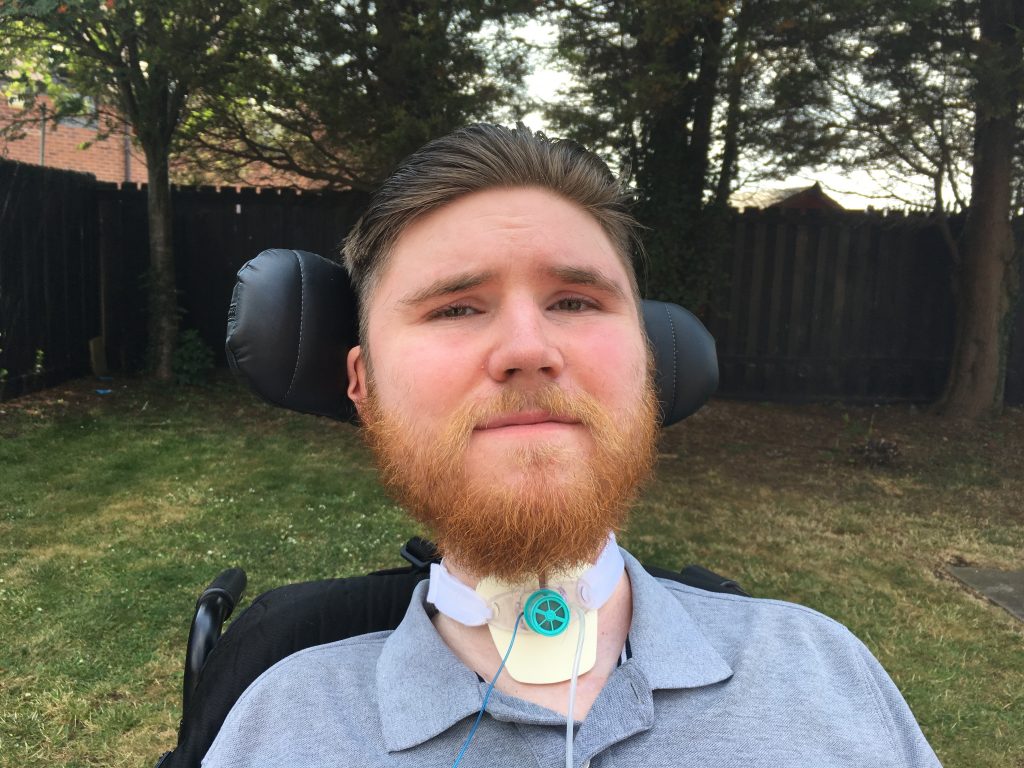BOBBY SHEARER sitting outside with his tracheostomy showing
