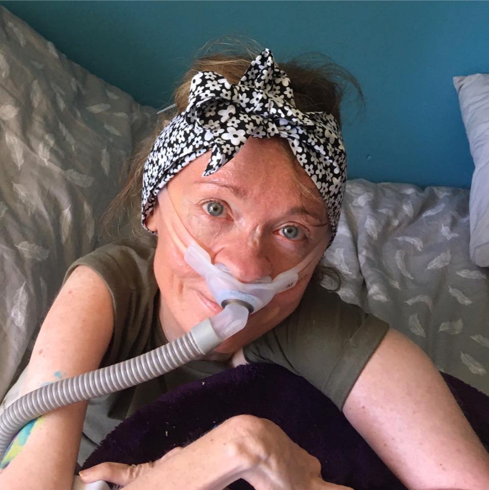 A photo of Sarah Rose, a white female wearing a black and white floral headband and a nasal ventilator mask. A blue wall is visible behind her.