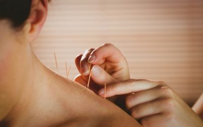 The Benefits of Combining Acupuncture and Physical Therapy