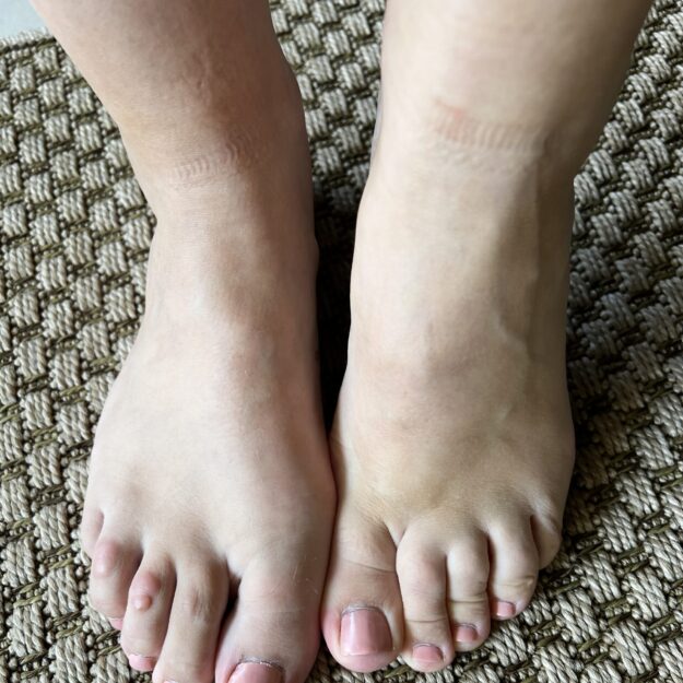 Velvetoes