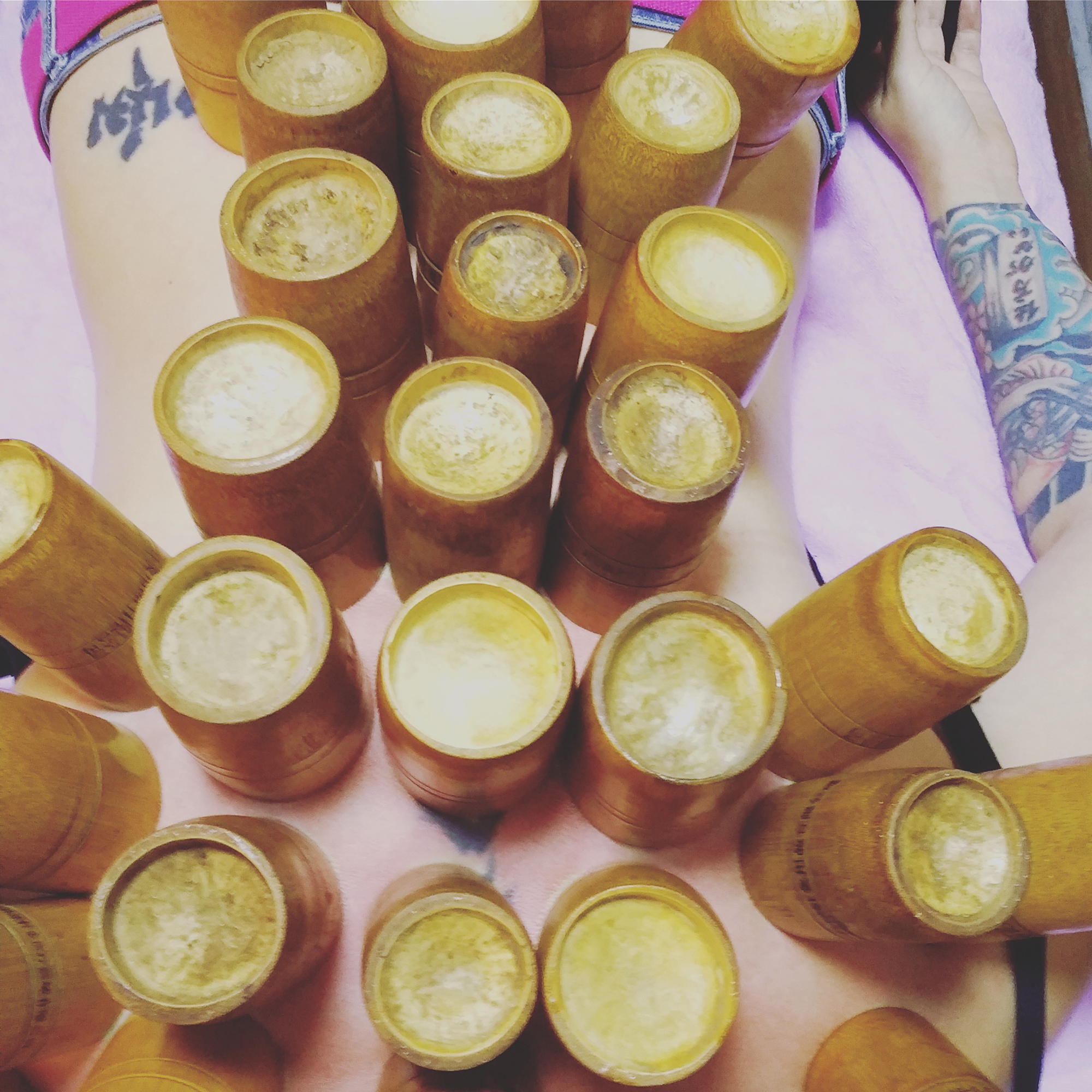 cupping oin a woman's back