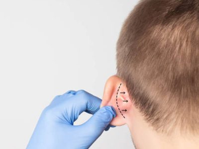 Plastische Ästhetische Chirurgie Gesichtsbehandlungen Ohrkorrekturen
