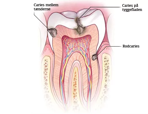Behandlinger i tænderne – Raadhussmilet