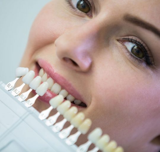 Dentist examining female patient with teeth shades at dental clinic