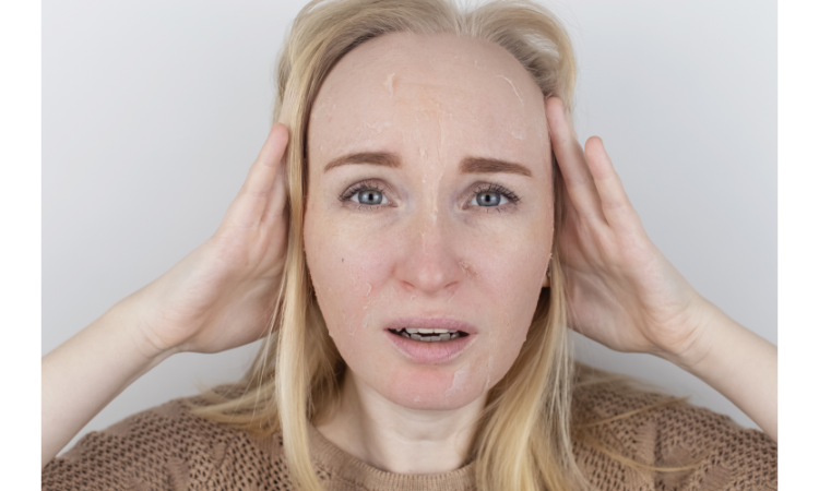 The Unseen Effects How Stress Takes a Toll on Your Skin's Health and Appearance