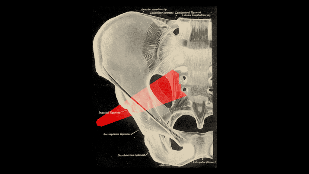 M. Piriformis: Kleiner Muskel - große Probleme 7 M. Piriformis: Kleiner Muskel - große Probleme 6
