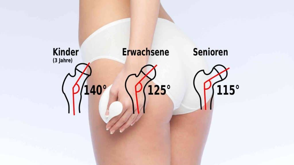 M. Piriformis: Kleiner Muskel - große Probleme 14 M. Piriformis: Kleiner Muskel - große Probleme 11