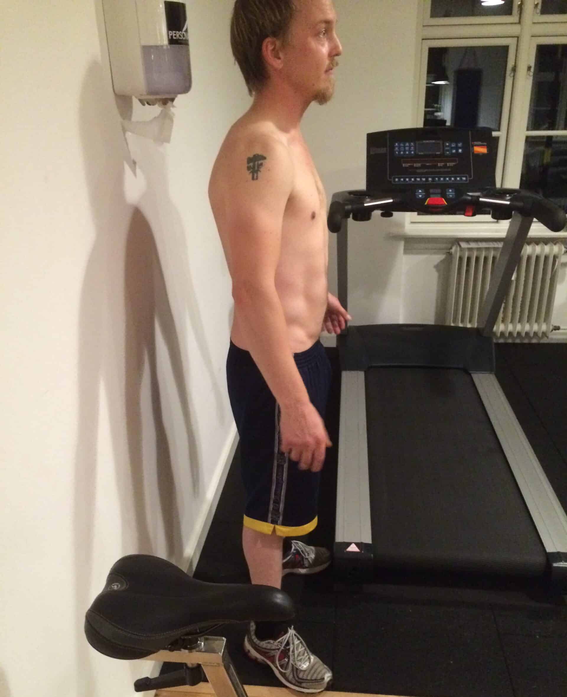 Jens fra siden  (efter)