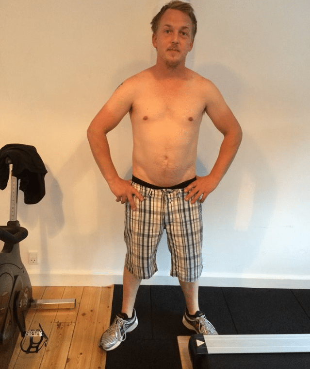 Jens forfra (før)
