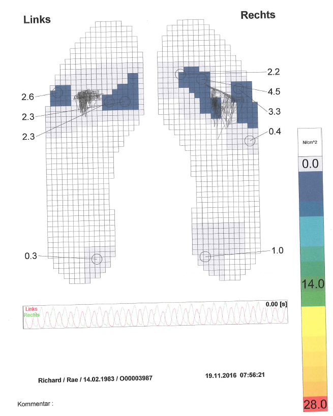 foot pressure points whilst peddling