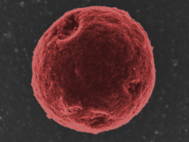 Particulate matter