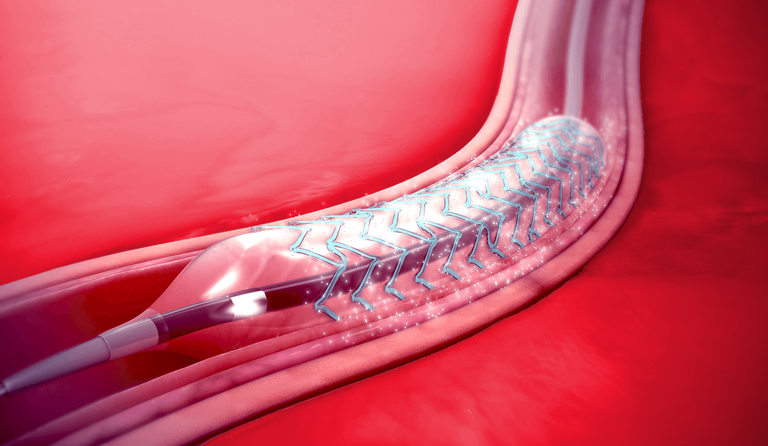 Safe Stents and Implants