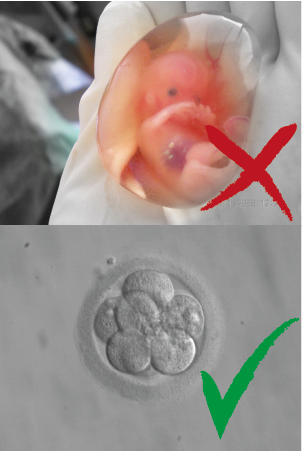 fetus-embryo