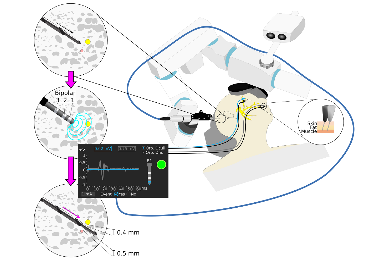 Anso J, et al. Front Surg. 2019, work duration: ca. 9 hours