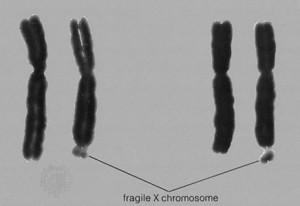 Xfragile