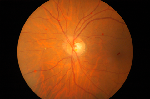 Fundus-Photography