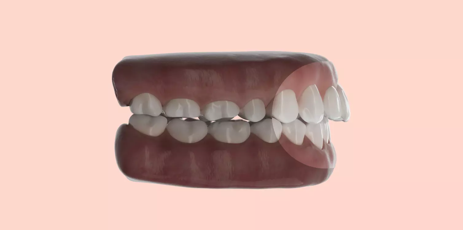Image link