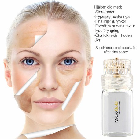 Mikrogold - Microbotox - Aquagold - Fullface.