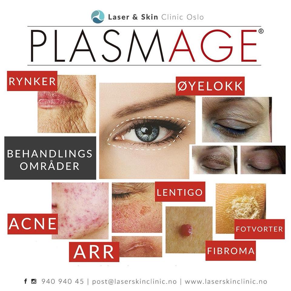 Plasmage