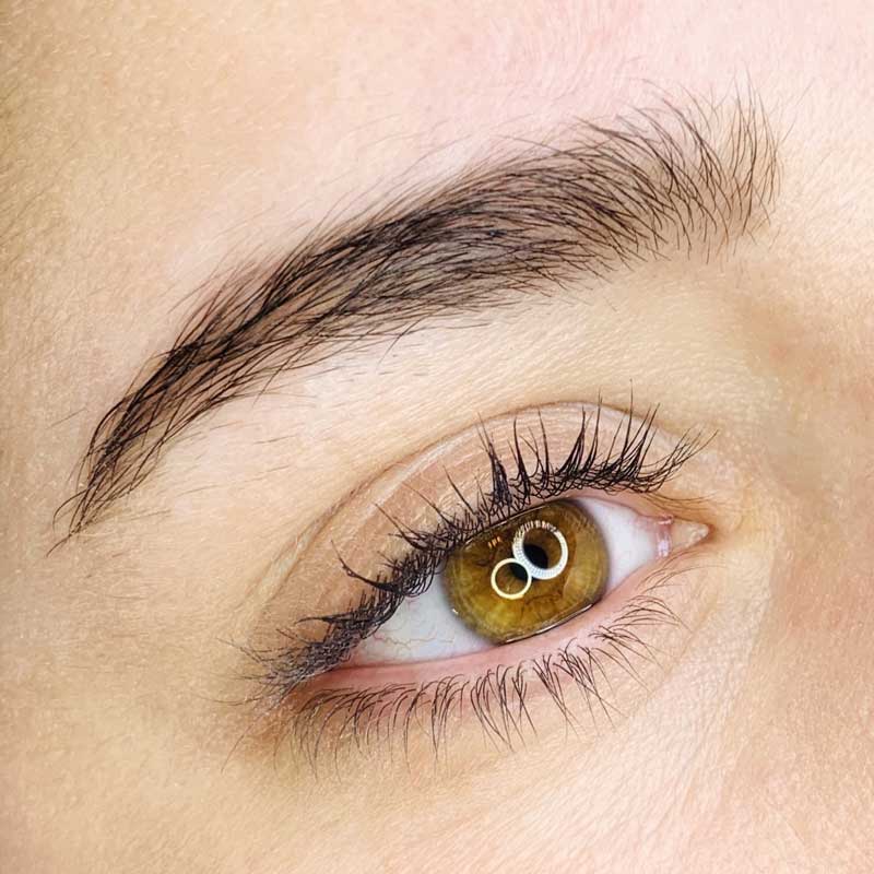 Browlift - före