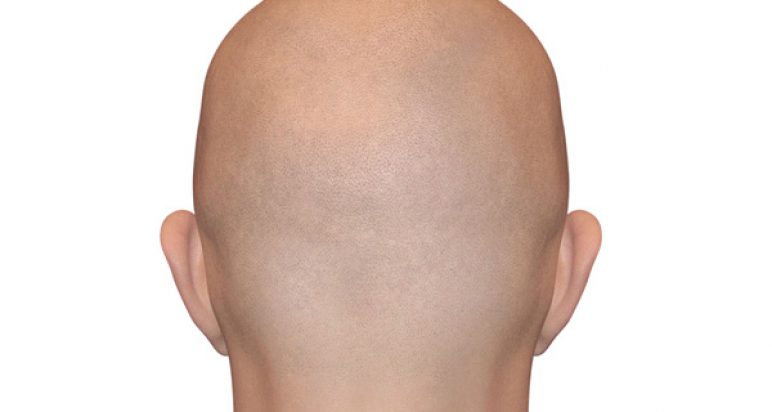 bald