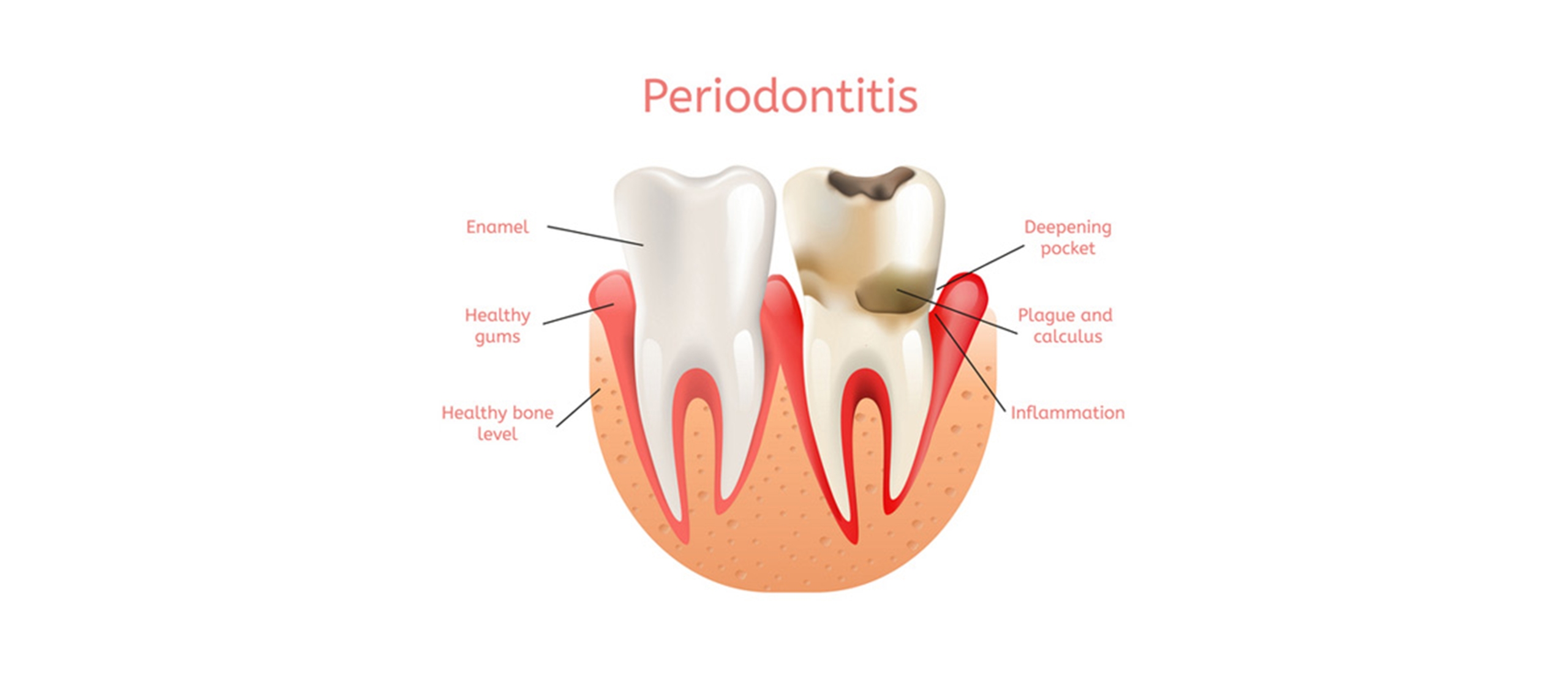 Våra behandlingar – Storvreta Tandklinik